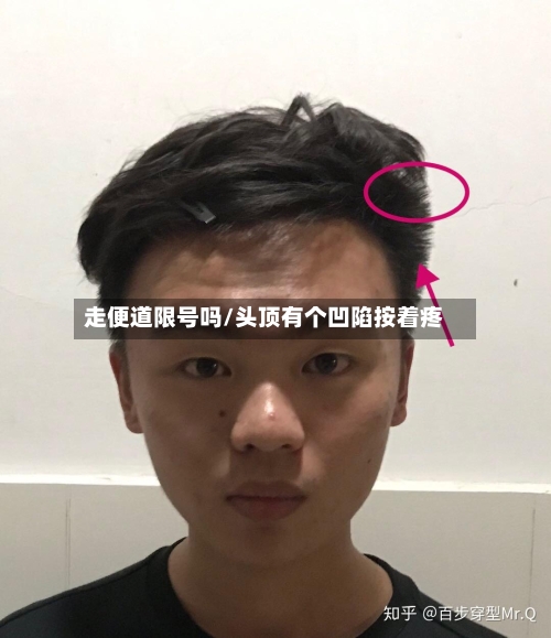 走便道限号吗/头顶有个凹陷按着疼-第2张图片